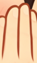 앞니 라미네이트 시술이 고민된다면 관련 이미지 34