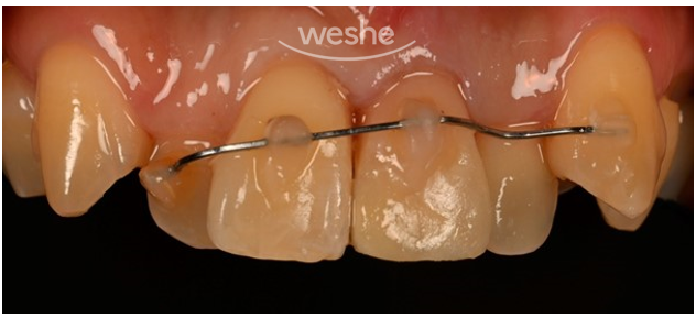 치과에서는 왜 자꾸 x-ray를 찍자고 하나요? 관련 이미지 10