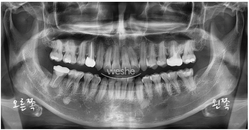 치과에서는 왜 자꾸 x-ray를 찍자고 하나요? 관련 이미지 3