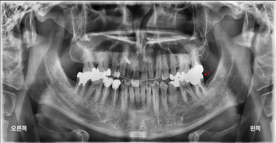 스마일디자이너 여상호원장 : 왜 보존과 전문의가 되었을까? 관련 이미지 2