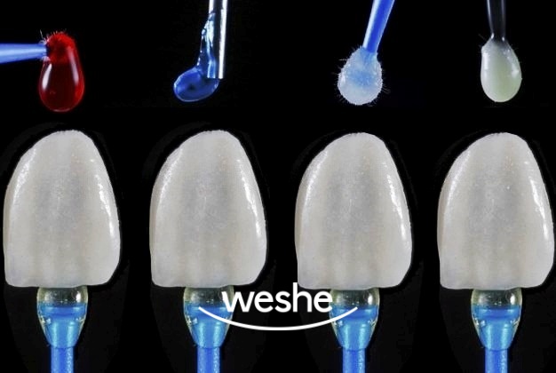 😁 웃을 때 치아 사이 가 벌어져 보인다면? 마곡동 치과 라미네이트 로 해결! 관련 이미지 11