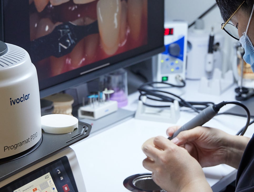 마곡역 치과 에서 알려드리는 직장인을 위한 라미네이트 , 여러 심미 수복물과 비교하면 어떤 장점이 있을까요? 관련 이미지 4