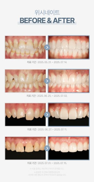 Magok Yonsei Wish Dental Clinic’s In-House Dental Lab System for Capturing Every Detail image 4