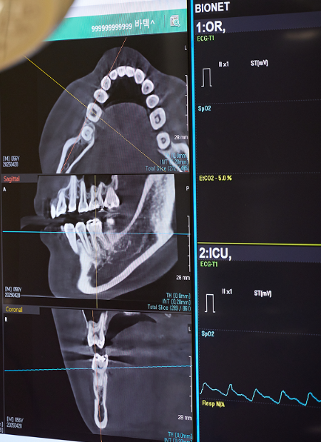 Could Fear of the Dentist Be Preventing You from Getting Implants? Conscious Sedation Implants at Magok Yonsei Wish Dental Clinic image 3