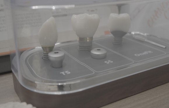Is a Loose Dental Implant a Sign That Revision Surgery Is Needed? image 3