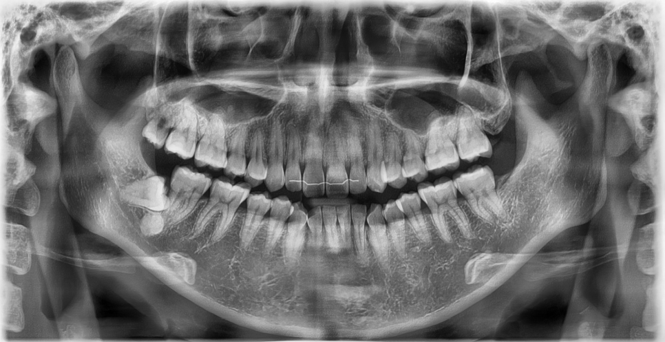치과에서는 왜 자꾸 x-ray를 찍자고 하나요? 관련 이미지 1
