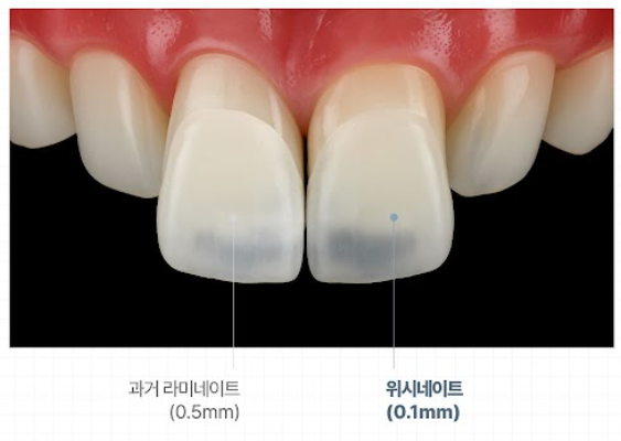 Magok Yonsei Wish Dental Clinic’s In-House Dental Lab System for Capturing Every Detail image 2
