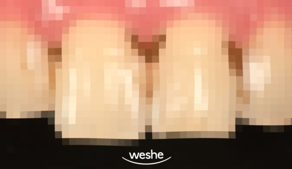 강서구 마곡 치과 벚꽃 시즌 전에 챙기는 심미치료 세 가지 관련 이미지 2