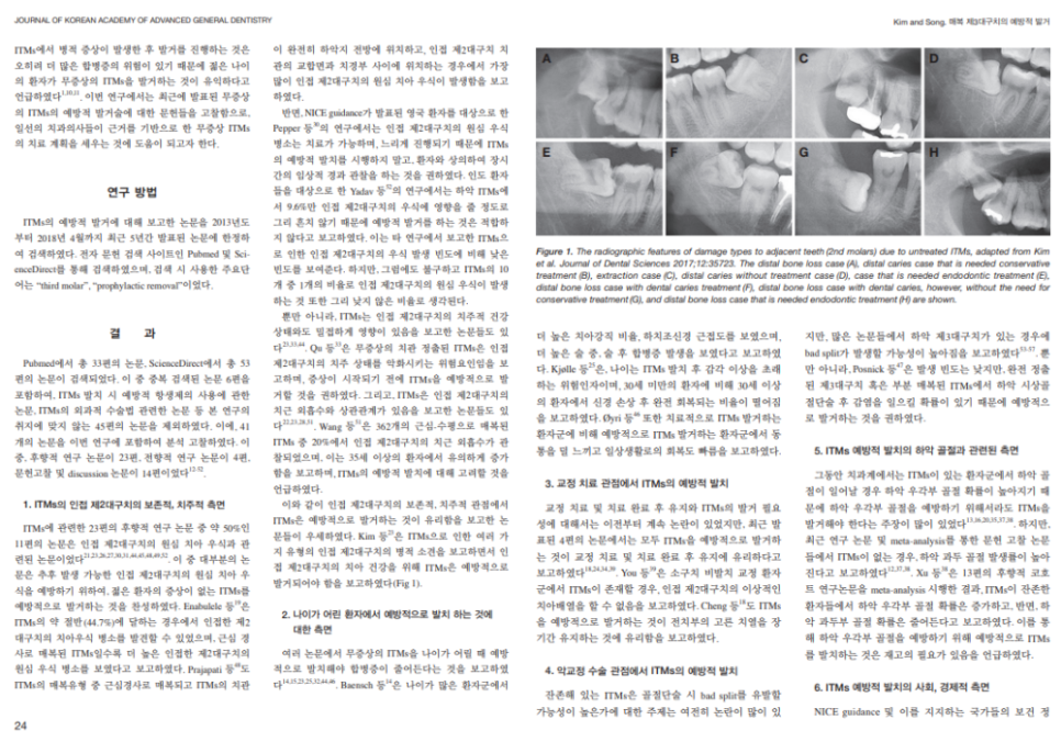 마곡역 수면치과 사랑니 발치 를 하는데 방해되는 덴탈 포비아, 극복할 수 있을까? 관련 이미지 1
