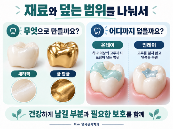 마곡 치아색 충치치료, 레진과 인레이가 다르게 들리는 이유 관련 이미지 5