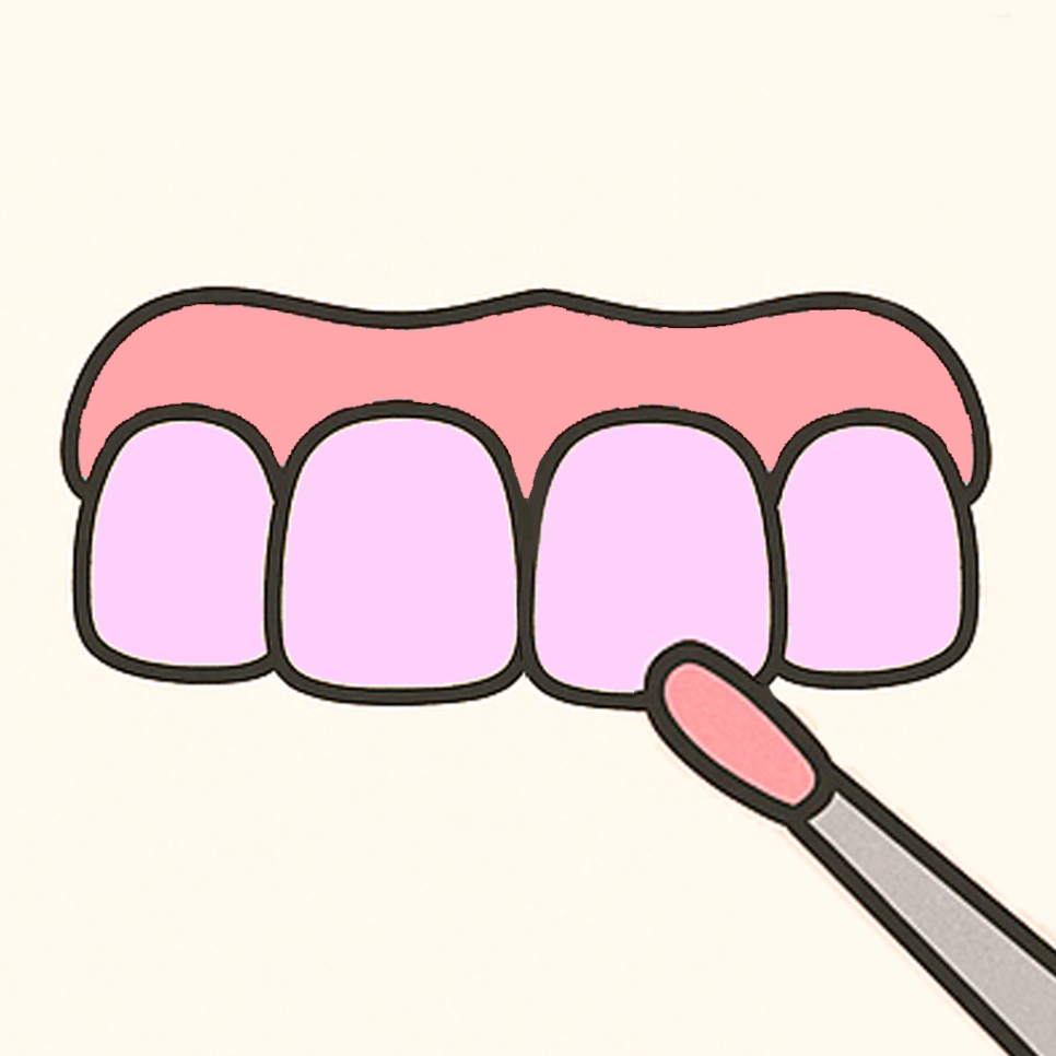 발산 치과 치아 미백 과정과 주의해야 되는 사항은? 담배, 커피 관련 이미지 6