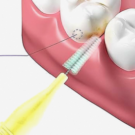 The Longevity of Cosmetic Restorations at a Gangseo-gu Dental Clinic Is Determined by Care More Than Materials image 6