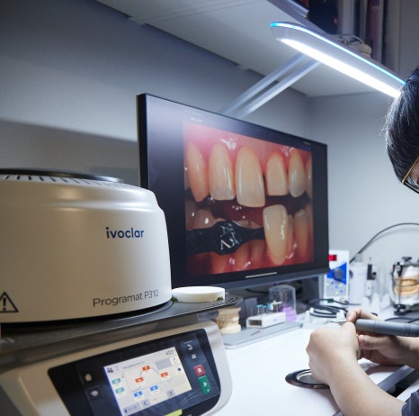 지르코니아크라운 라미네이트 보철물 차이, 자연스러운 미소를 결정하는 포인트는? 마곡역 치과 관련 이미지 4