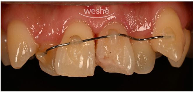 치과에서는 왜 자꾸 x-ray를 찍자고 하나요? 관련 이미지 6