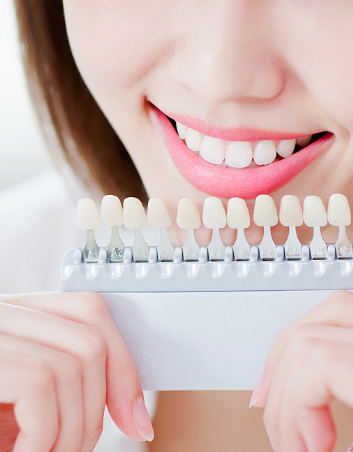 Magok Teeth Whitening: WISH Whitening Combining Professional and At-Home Whitening image 1