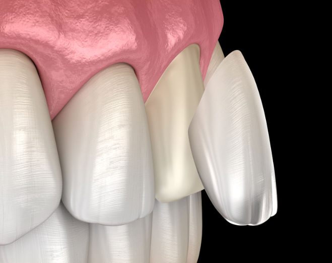 스마일디자이너 여상호원장 : 왜 보존과 전문의가 되었을까? 관련 이미지 4