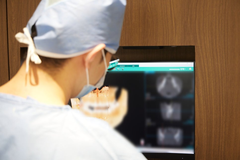 강서구 치과 어금니 임플란트 가용골 부족할 때 네비게이션 1차 2차 수술 로 해결하는 방법 관련 이미지 1