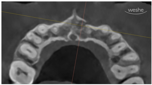 치과에서는 왜 자꾸 x-ray를 찍자고 하나요? 관련 이미지 7