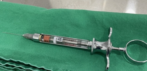 How Painful Is Dental Anesthesia? | Magok Dental Clinic image 4