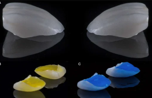 앞니 끝 깨짐 연세위시치과 라미네이트 제작 과정, 관리 관련 이미지 5