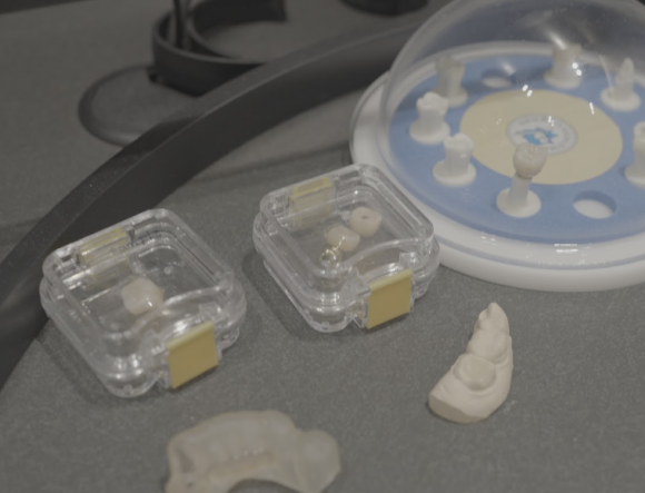 Is a Loose Dental Implant a Sign That Revision Surgery Is Needed? image 4
