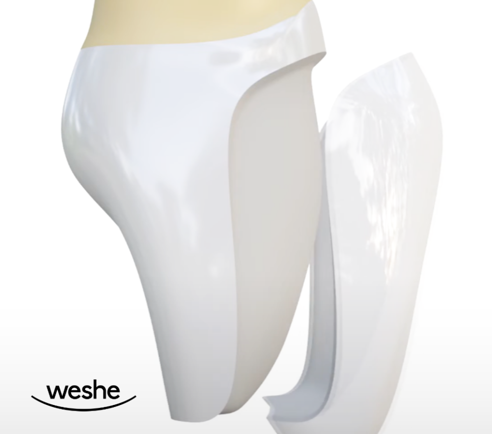 강서구 치과 웃을 때 앞니가 이상해 보인다면? 라미네이트 치료 로 자신감을 되찾으세요 관련 이미지 3