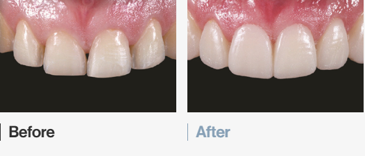 Magok Yonsei Wish Dental Clinic’s In-House Dental Lab System for Capturing Every Detail image 7