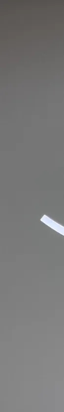 When Is Bone Grafting Needed for Dental Implants? Magok Dental Clinic image 21