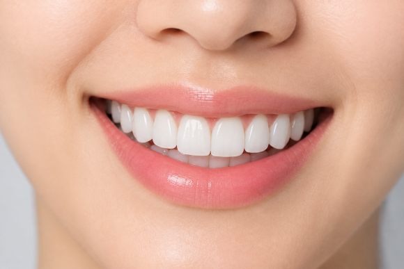 If Your Veneer Falls Off: When It Can Be Reattached and What to Do | Magongnaru Station Dental Clinic image 4