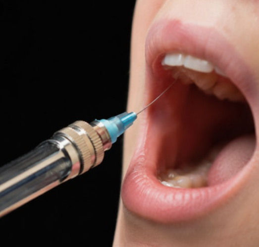 How Painful Is Dental Anesthesia? | Magok Dental Clinic image 3