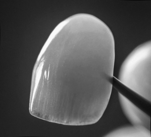 강서구 마곡 치과 벚꽃 시즌 전에 챙기는 심미치료 세 가지 관련 이미지 5