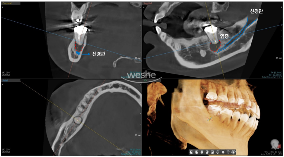 치과에서는 왜 자꾸 x-ray를 찍자고 하나요? 관련 이미지 5