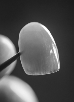 Magok Yonsei Wish Dental Clinic’s In-House Dental Lab System for Capturing Every Detail image 3