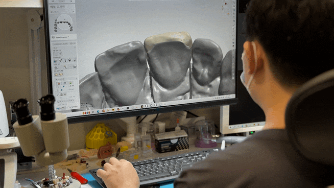 위시네이트 A to Z, 연세위시치과 여상호 대표원장이 알려드립니다. 관련 이미지 4