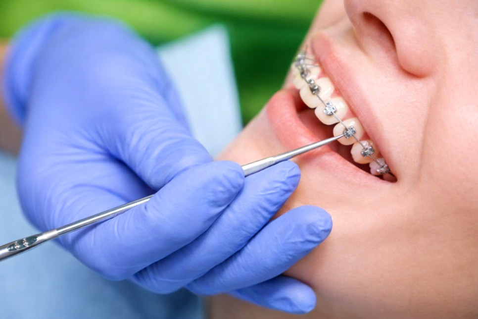 스케일링 후 시려서 미루고 계셨나요? 강서구 치과 에서 설명하는 에어플로우 관련 이미지 3