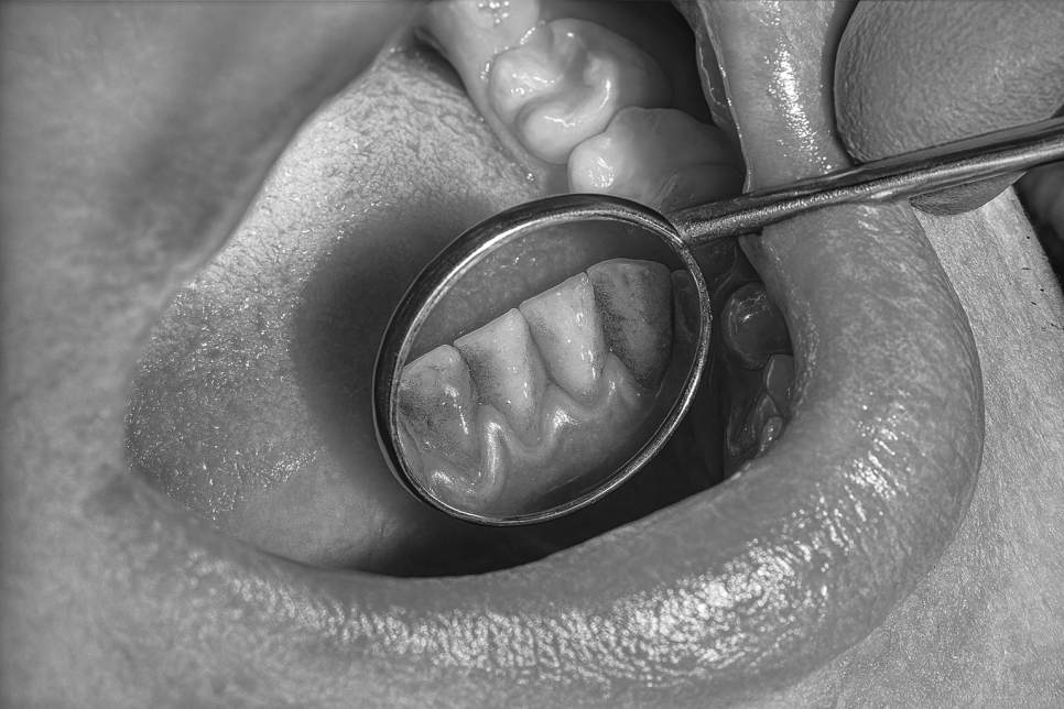 마곡 치과 잇몸치료 후 술 이때까지는..! 관련 이미지 4