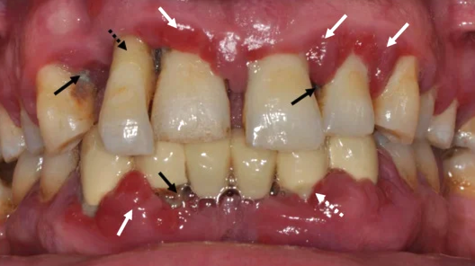 마곡동 치과 정밀 구강 진단을 위한 엑스레이(X-ray) 촬영 필요성과 원리 관련 이미지 1