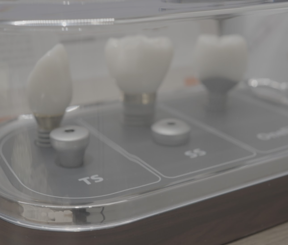 What Is Important for Keeping Front Tooth Resin Looking Natural and Lasting Longer? image 5