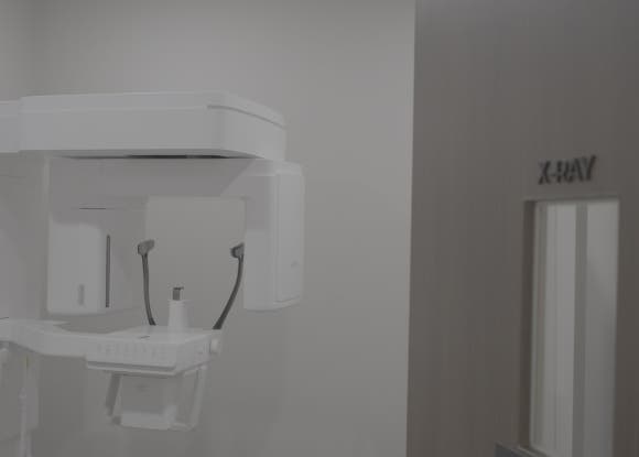 What Is Important for Keeping Front Tooth Resin Looking Natural and Lasting Longer? image 2
