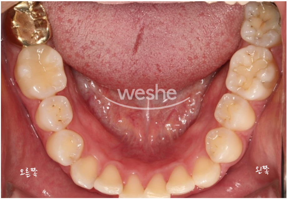 치과에서는 왜 자꾸 x-ray를 찍자고 하나요? 관련 이미지 2