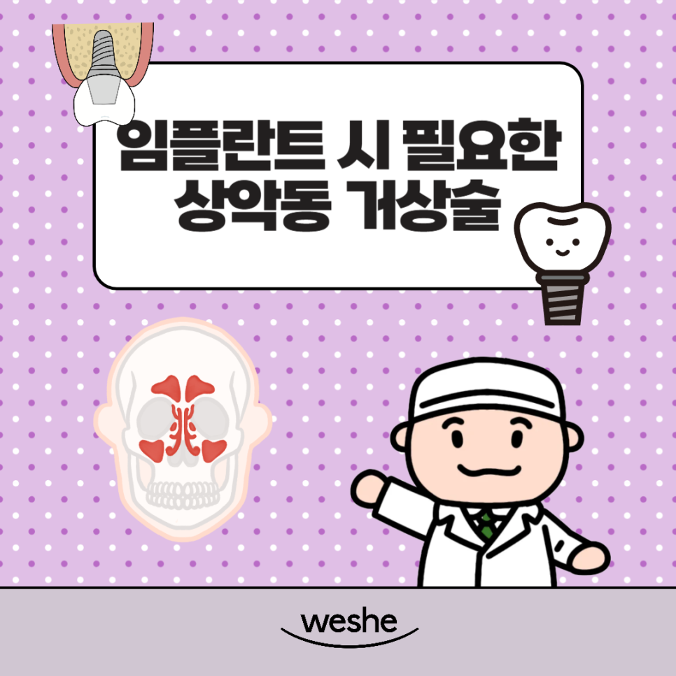 마곡역 치과 임플란트 식립 수술 시 필요한 상악동 거상술 종류 관련 이미지 6