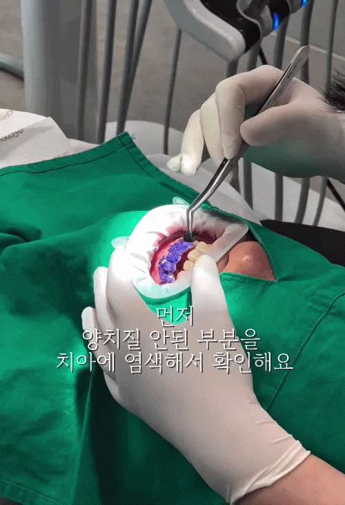 좋은 치과는 치료보다 관리를 먼저 생각합니다- 에어플로우 스케일링 연세위시치과 관련 이미지 5