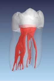 신경치료, 알고 계셨나요? 우리가 꼭 알아야 할 이야기 관련 이미지 1