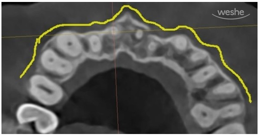 치과에서는 왜 자꾸 x-ray를 찍자고 하나요? 관련 이미지 8