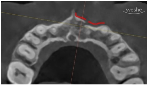 치과에서는 왜 자꾸 x-ray를 찍자고 하나요? 관련 이미지 9