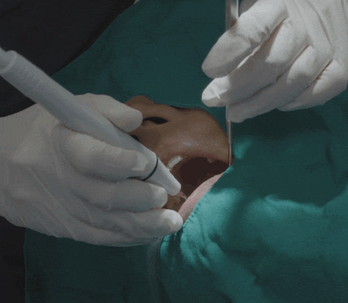 연세위시치과 여상호 대표원장이 알려주는 신경치료의 중요성(feat. 치과보존과 전문의) 관련 이미지 7