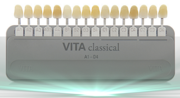 Magok Teeth Whitening: WISH Whitening Combining Professional and At-Home Whitening image 7