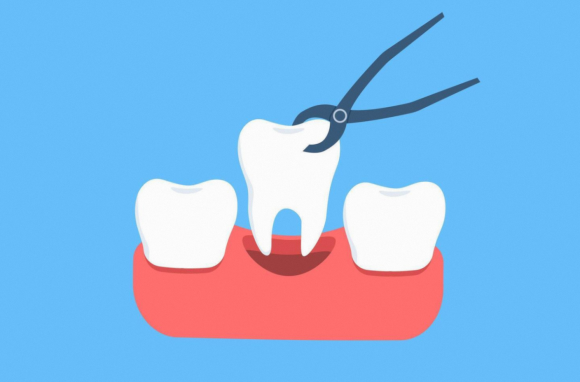 Magok Station Dental Clinic: Feeling Nervous and Shaky Before Implant Surgery? Knowledge Is Power image 2