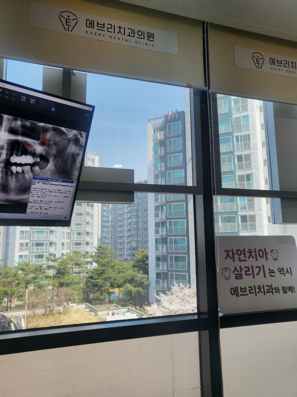 강서구 치과, 임플란트한 치아가 불편한 이유 관련 이미지 2