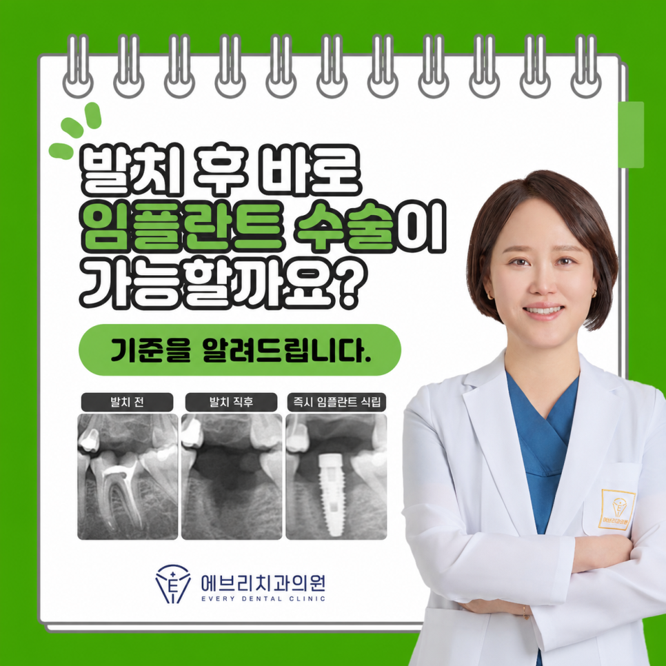 치아 뽑고 바로 임플란트 가능할까요? 내발산동 치과에서 알려드립니다. 관련 이미지 11